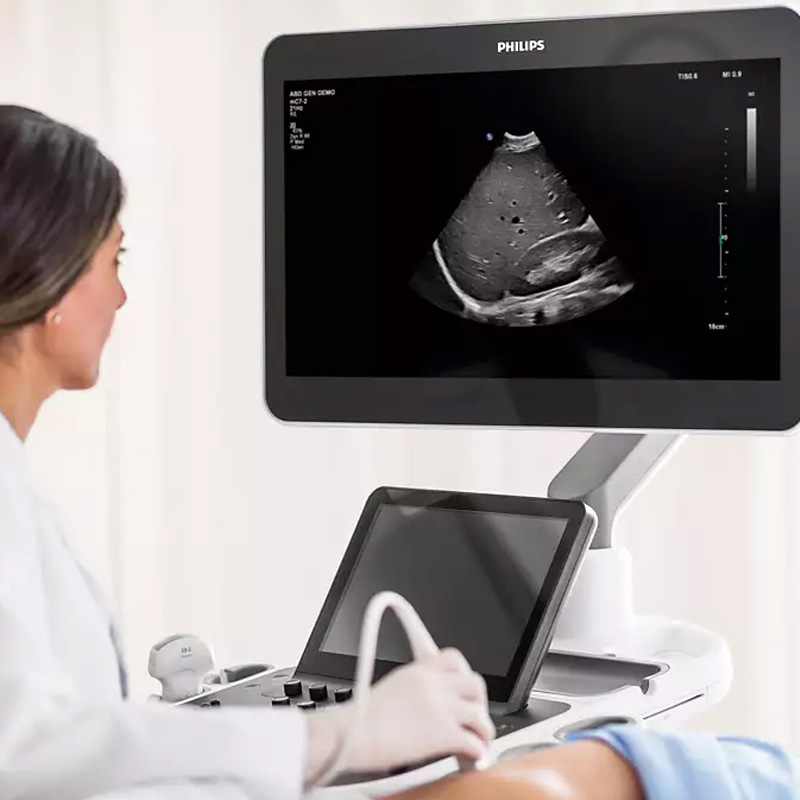 Ультразвуковая система премиального класса Philips EPIQ Elite